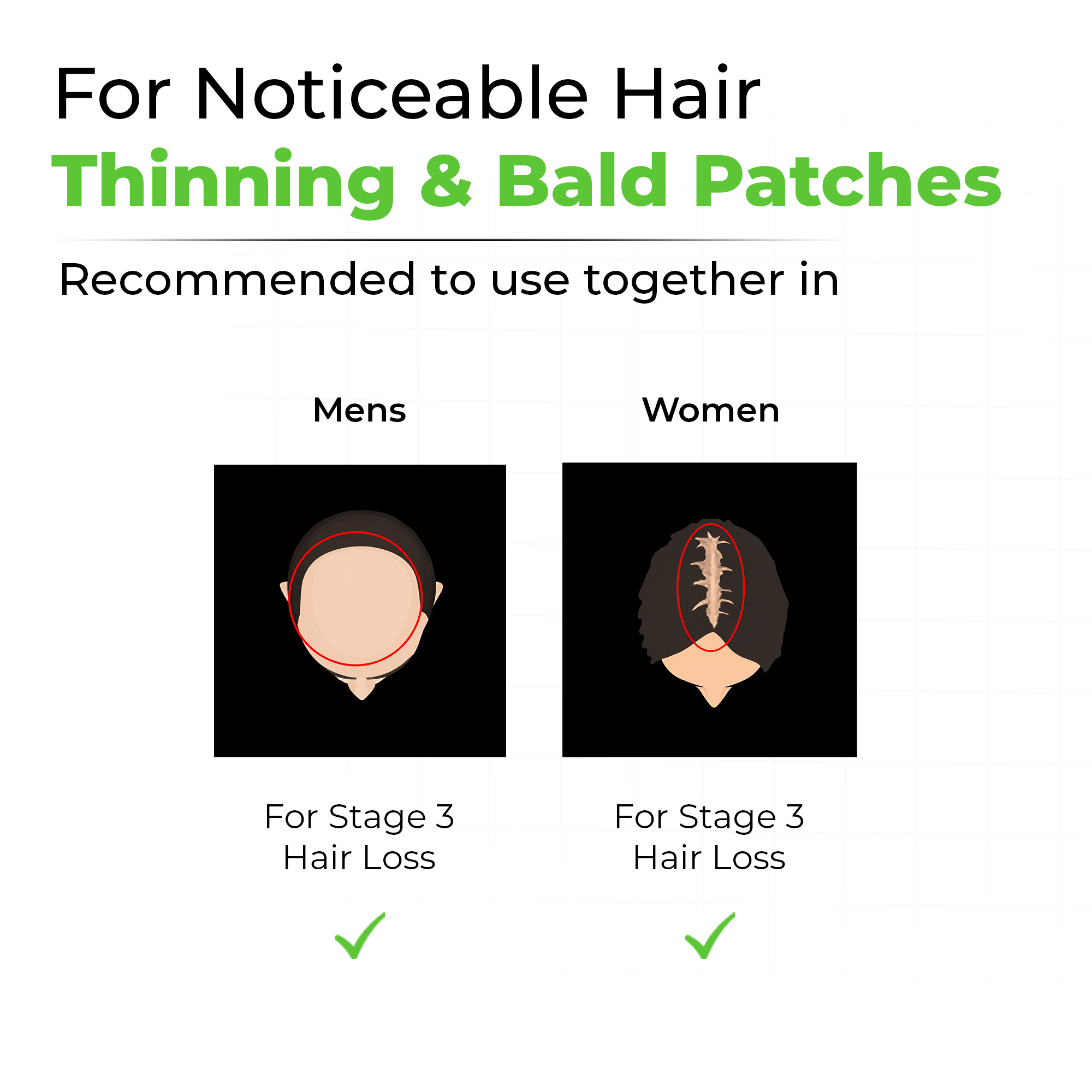 Hair Growth Kit for Stage 3 Hair Loss