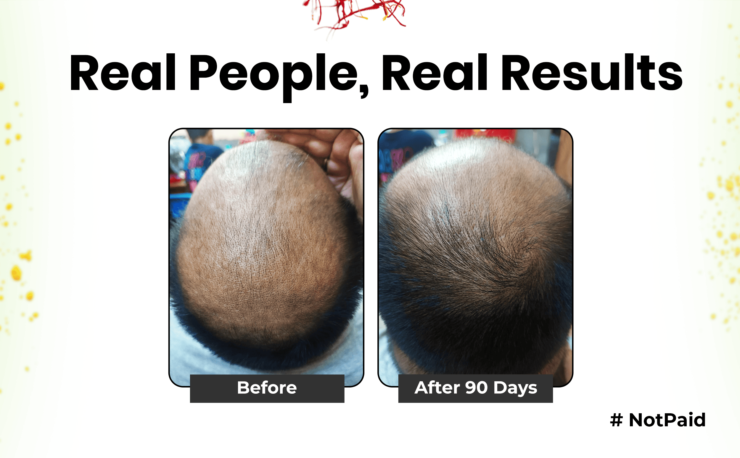 Keshpallav Hair Oil for Stage 1 & 2 Hair Loss