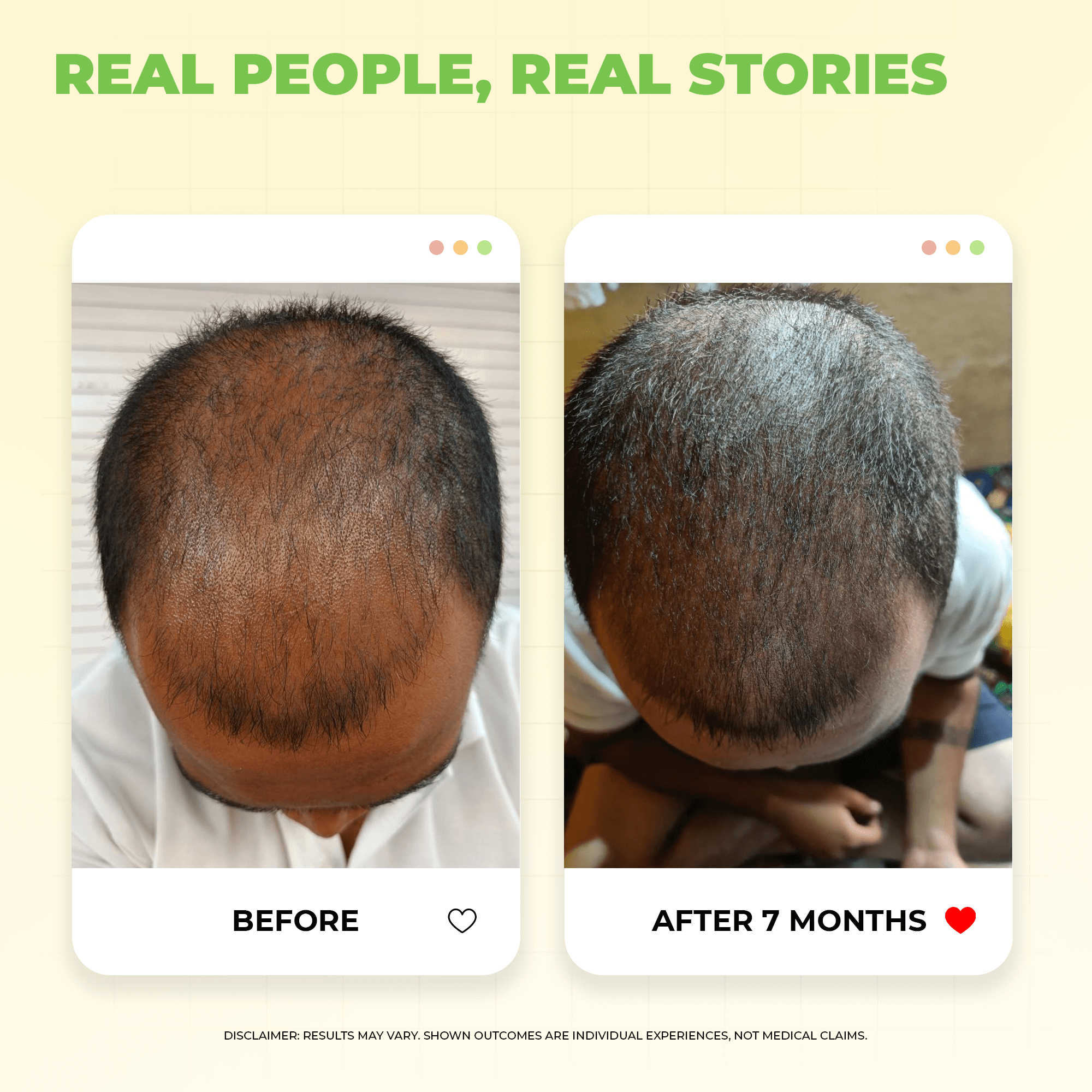 Keshpallav Hair Oil for Hair Growth with 5% Nansyl & Rosemary Extracts