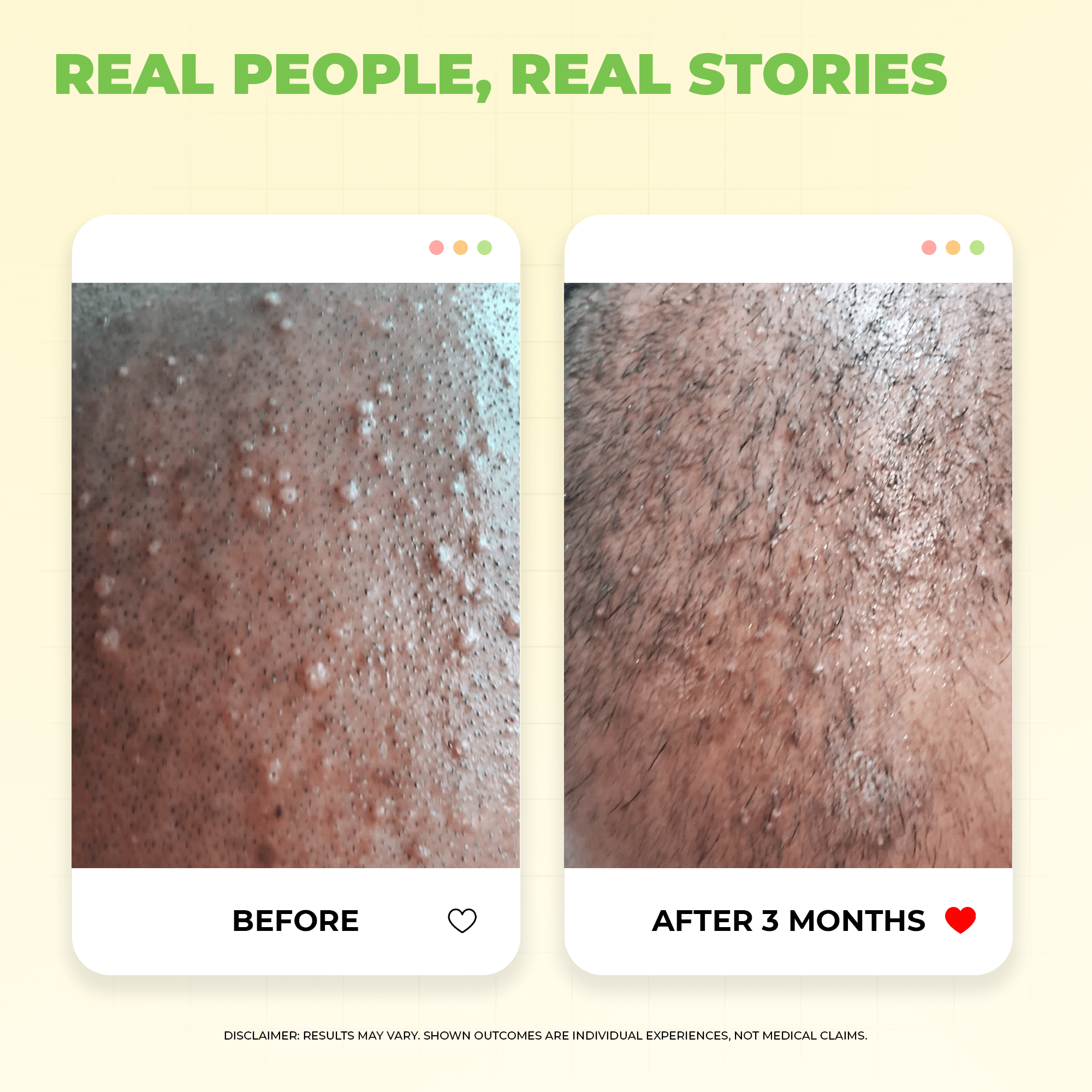 Instant Water Softener for Hair Loss Due to Hard Water