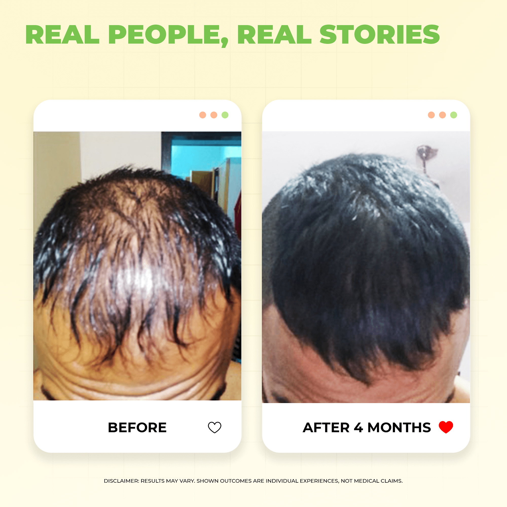 Hair Tonic PV 1 Scalp Spray A Natural DHT Blocker