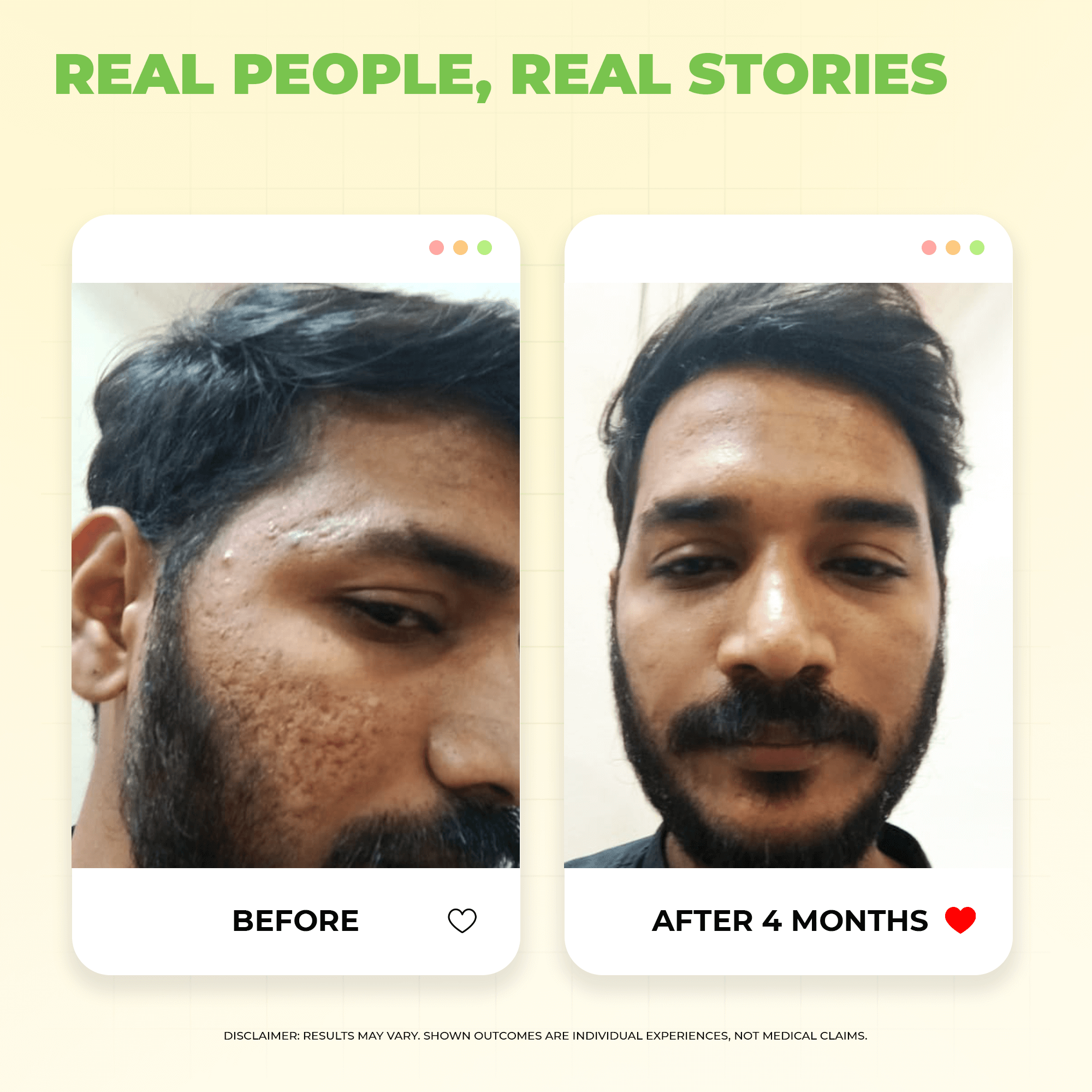 Vitamin C Serums for Face: Glowing Skin & Anti-Aging Benefits