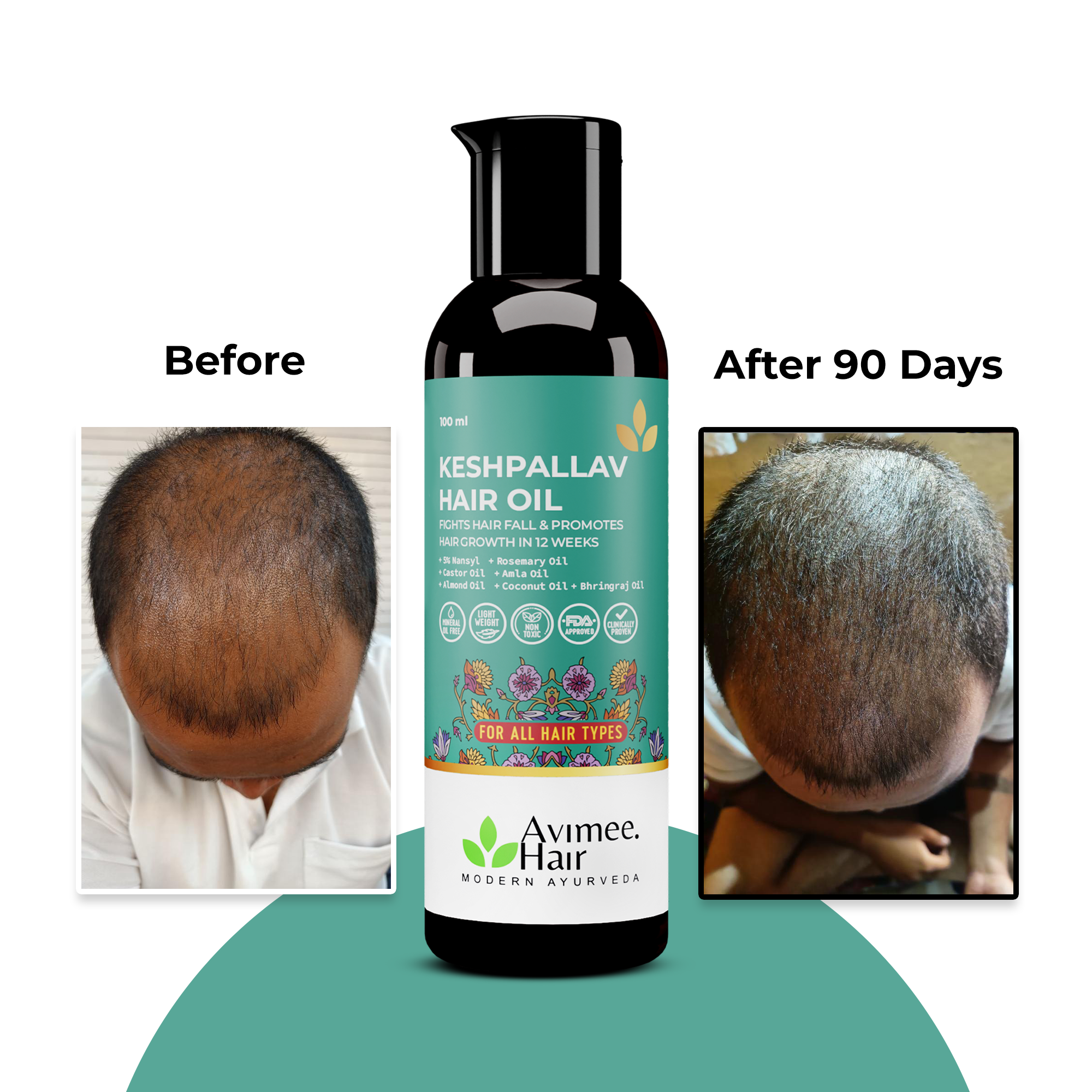 Keshpallav Hair Oil + Shakuntala Daily Use Shampoo Super Saver Combo