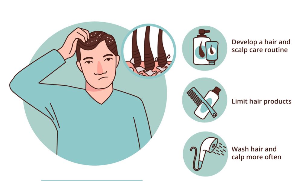 Dandruff Vs. Dry Scalp: What's The Difference?