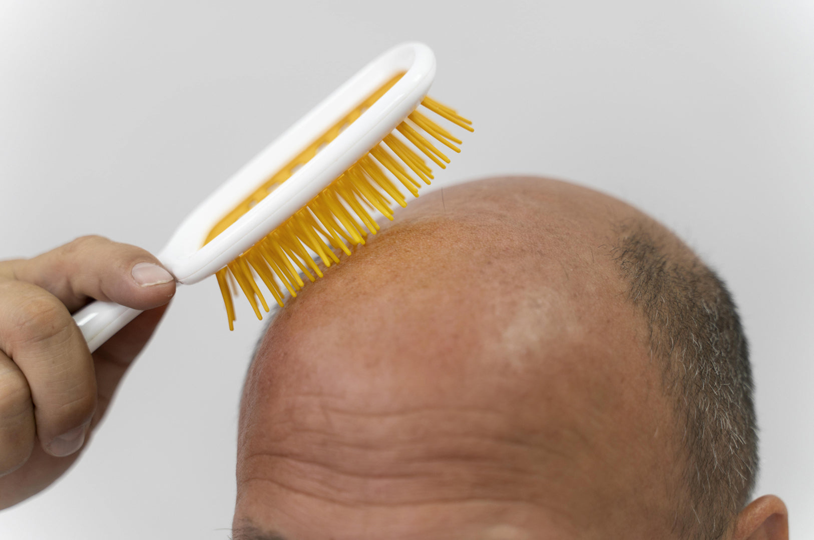 Baldman using comb on his Scalp