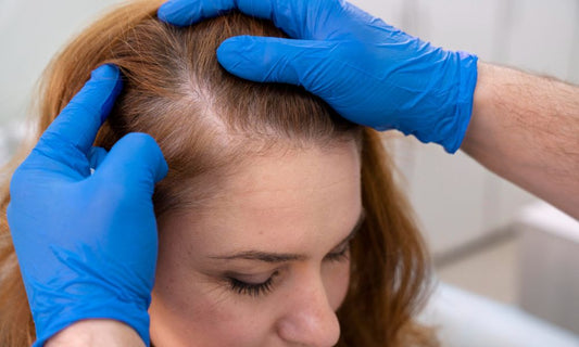How to Check Your Hair Density: A Simple Guide