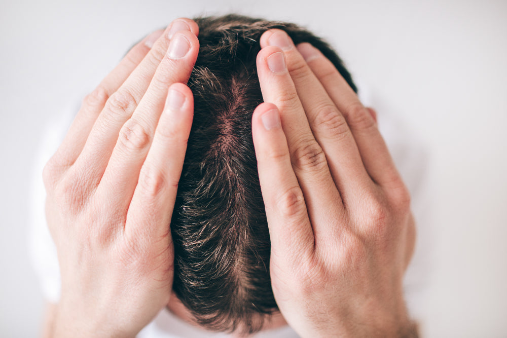 Hair Loss in Adults