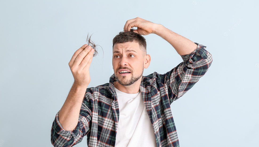 Young men facing a issue with hairfall