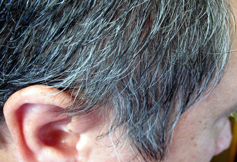 Ayurvedic DIY Remedies for Pre-Mature Greying of Hair | 1 Minute Read