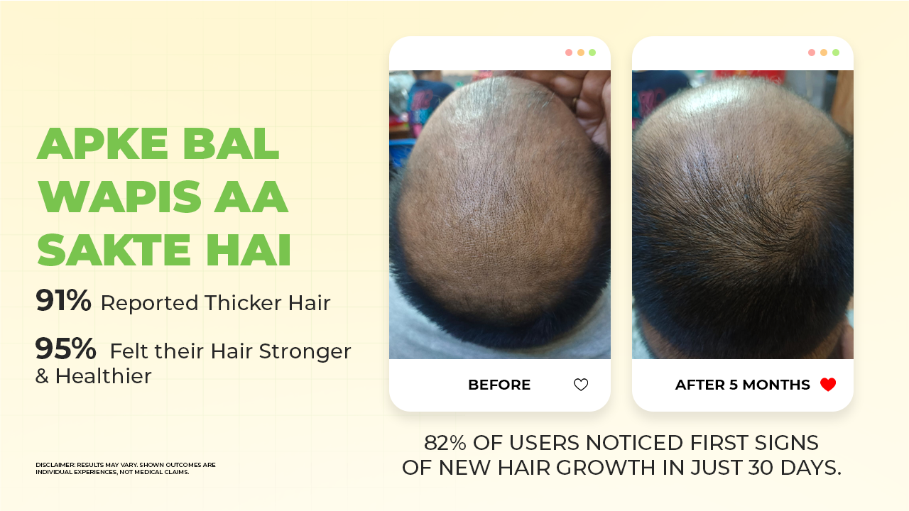 Scalptone Hair Growth Serum with 5% Nansyl & Pea Sprout Extract