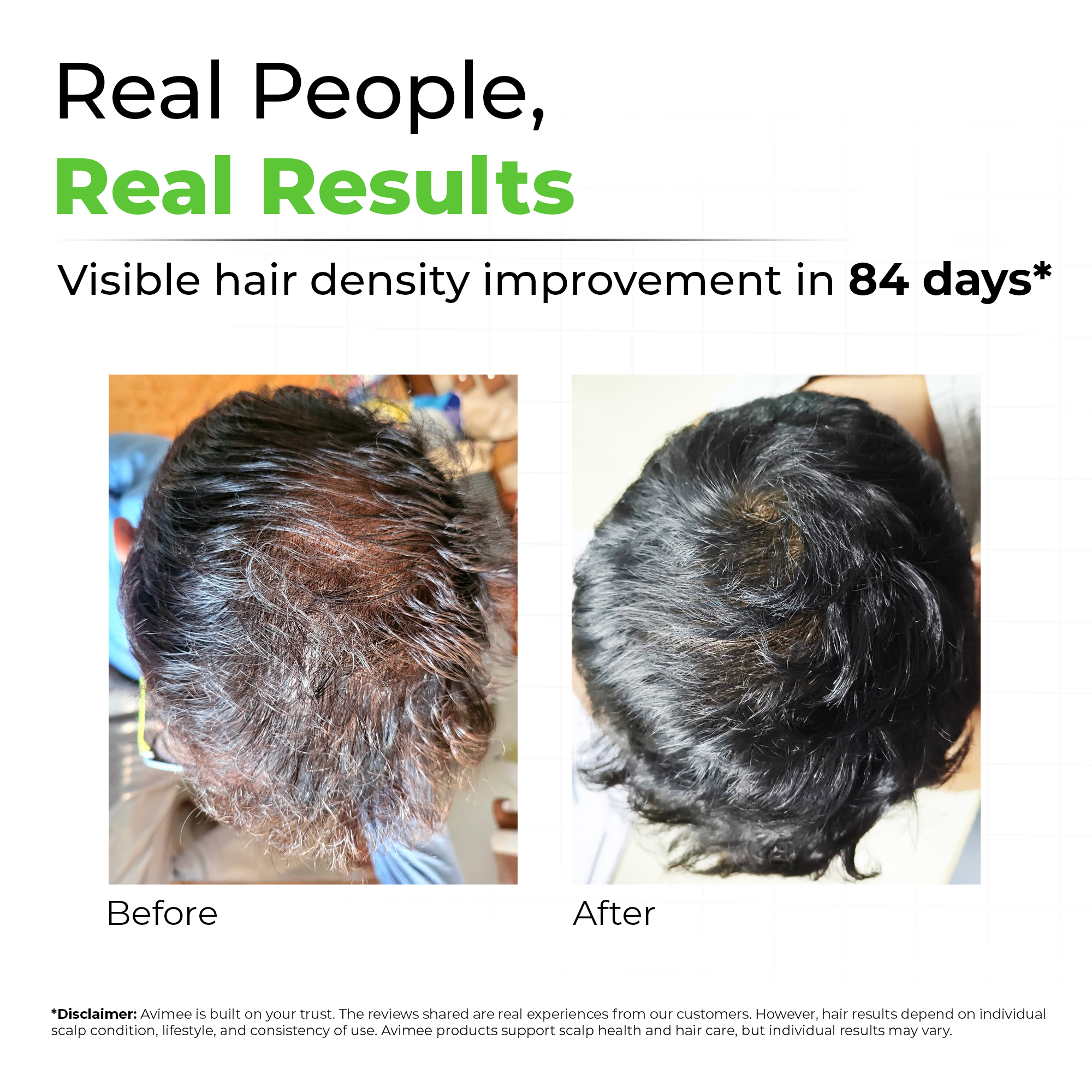 Rosemary Water for Hair and Skin