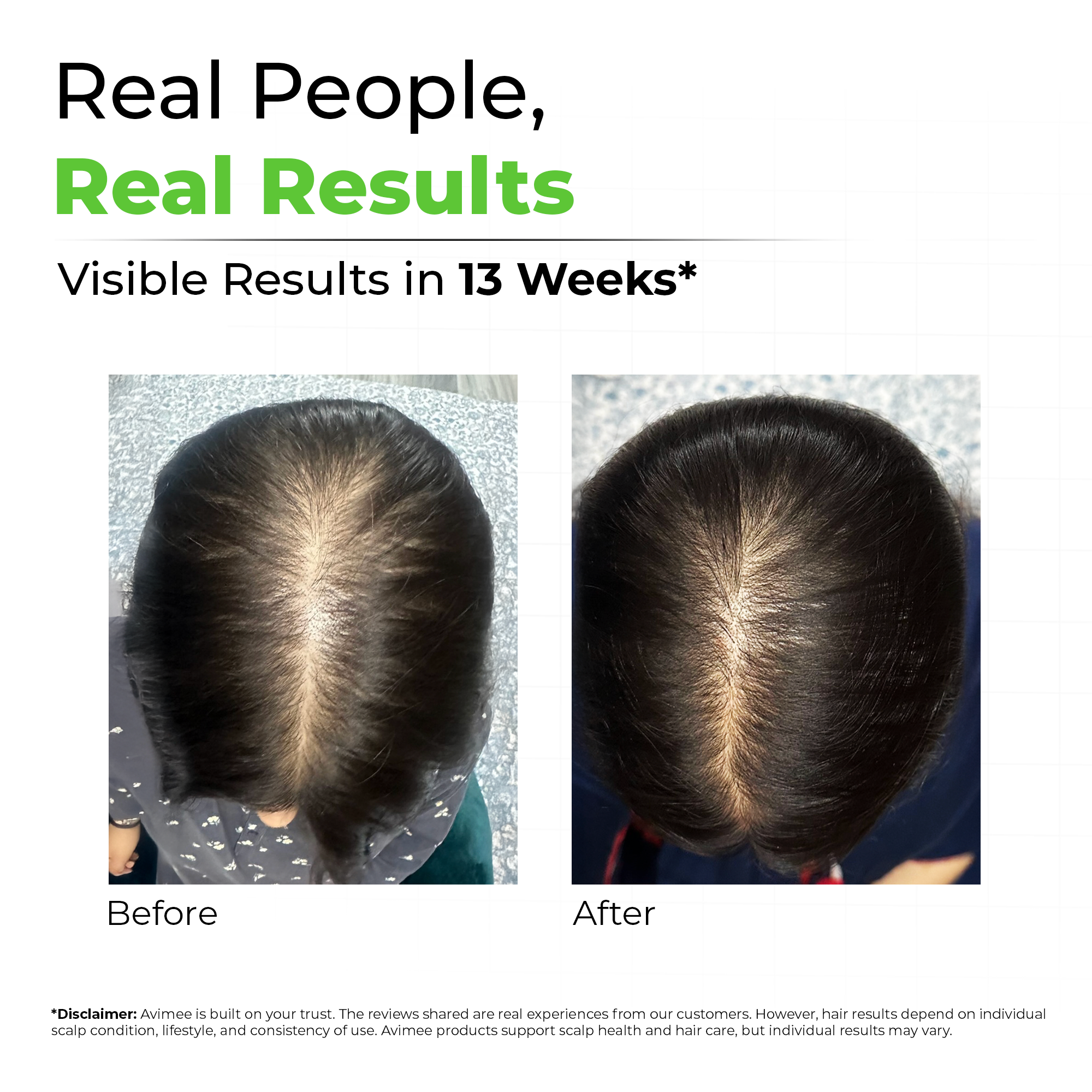 Rosemary Hair Oil for Hair Growth