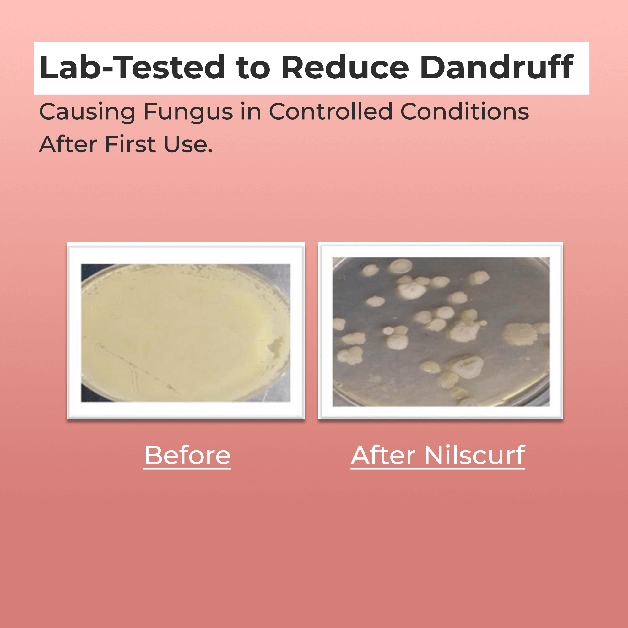 Scalptone Dandruff Serum