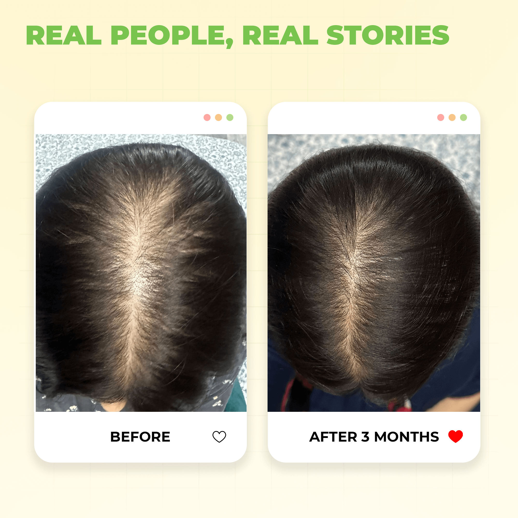 Extra Virgin Coconut Oil For Winters