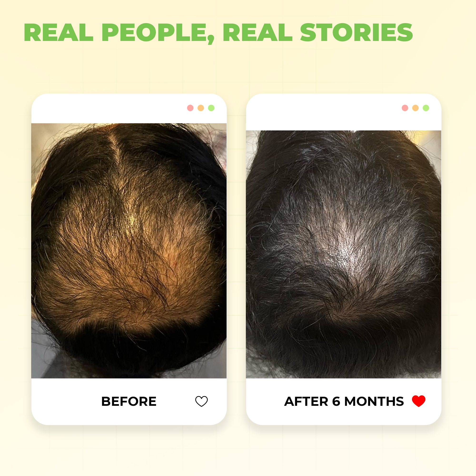 Cold Pressed Sweet Almond Hair Oil