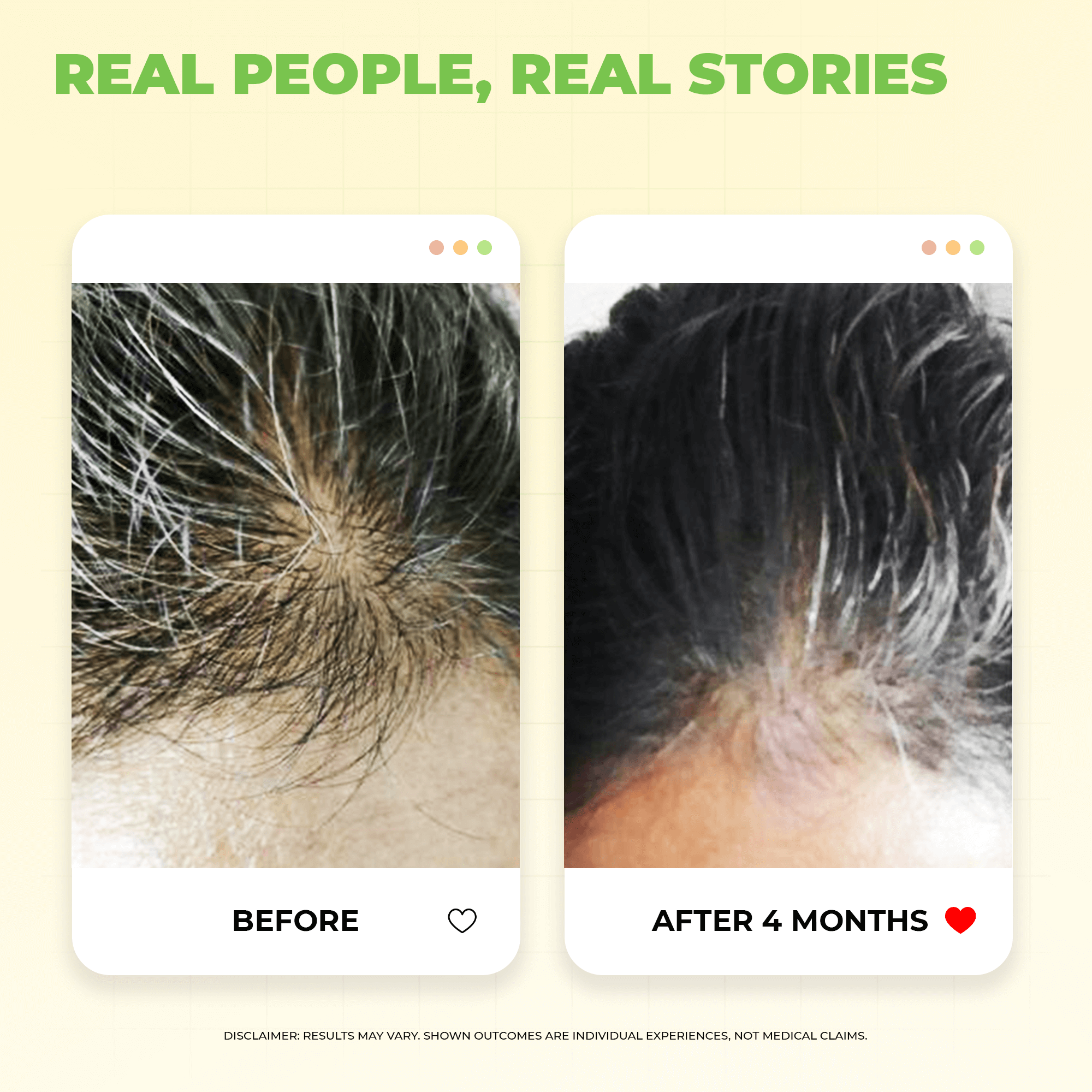 Scalptone Grey Hair Serum