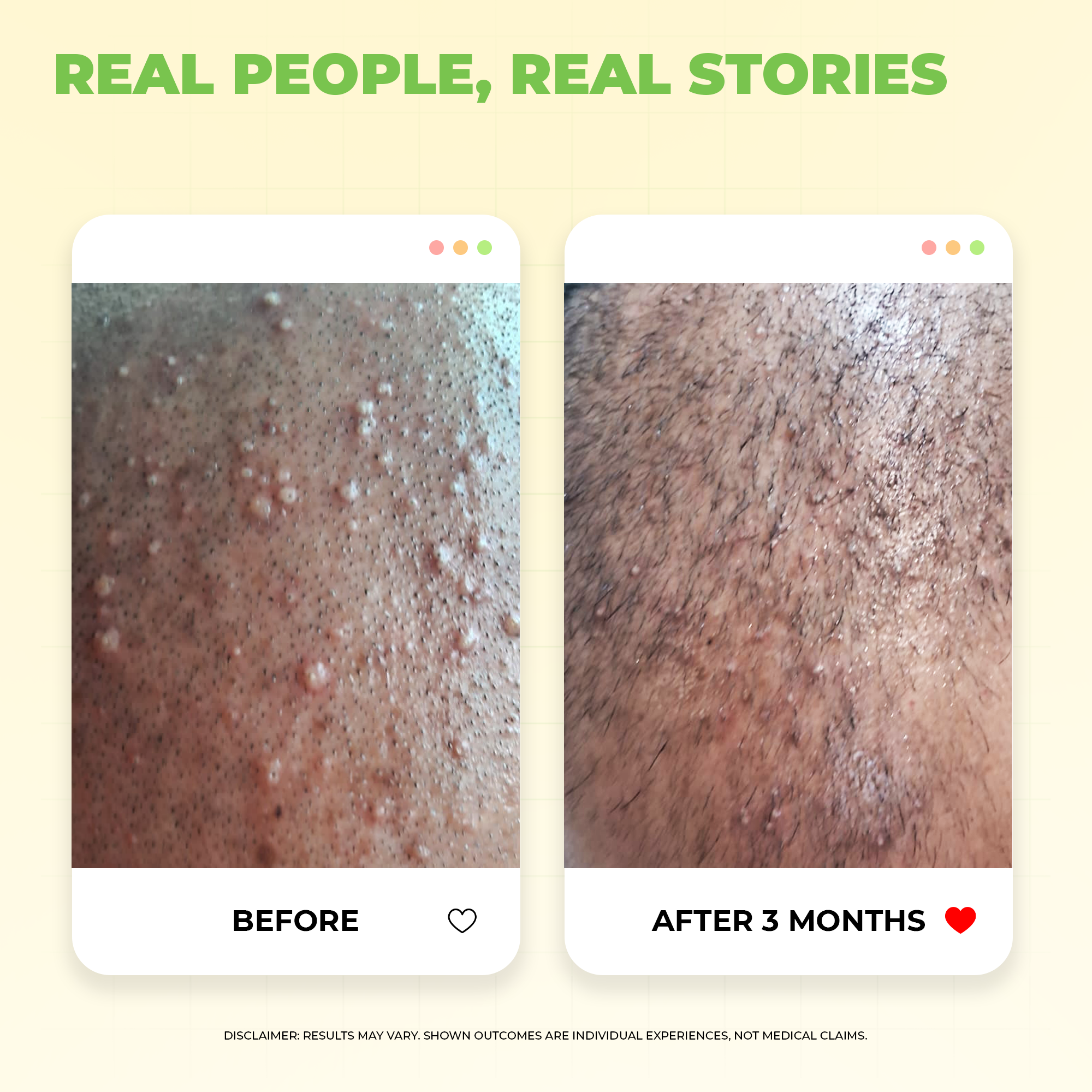 Instant Water Softener for Hair Loss Due to Hard Water Pack Of 2