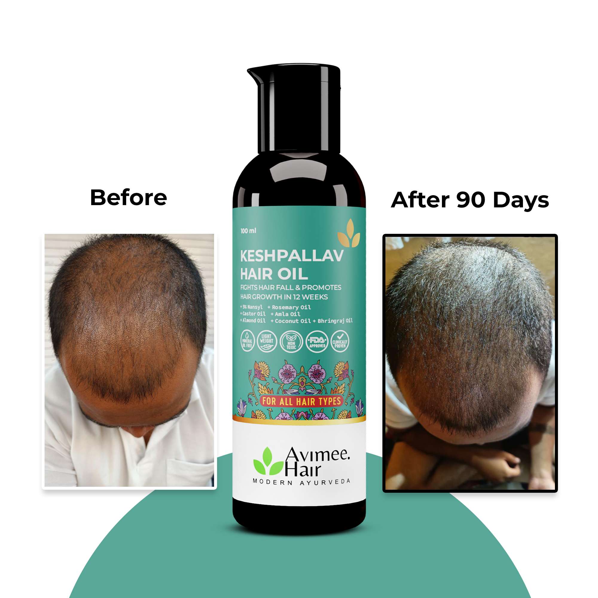 Hair Growth Kit; Keshpallav Hair Oil, Shakuntala Hair Cleanser and Scalptone Hair Growth Serum